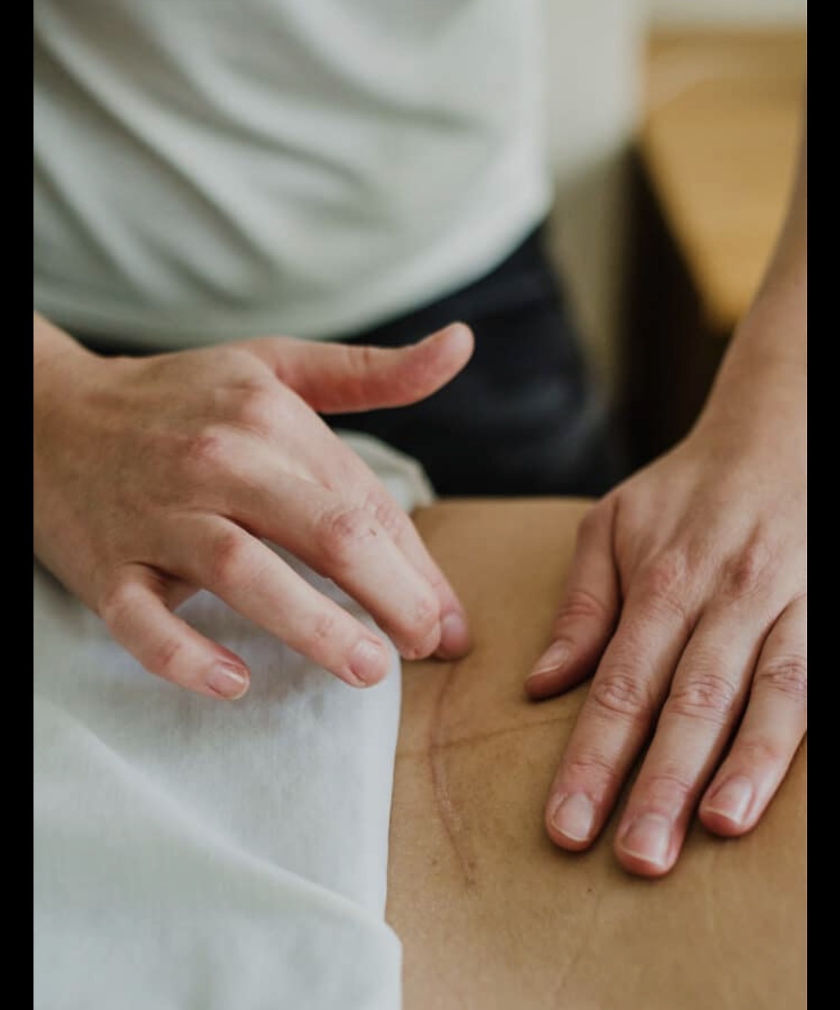 Close-up of dry needling between the shoulder blades