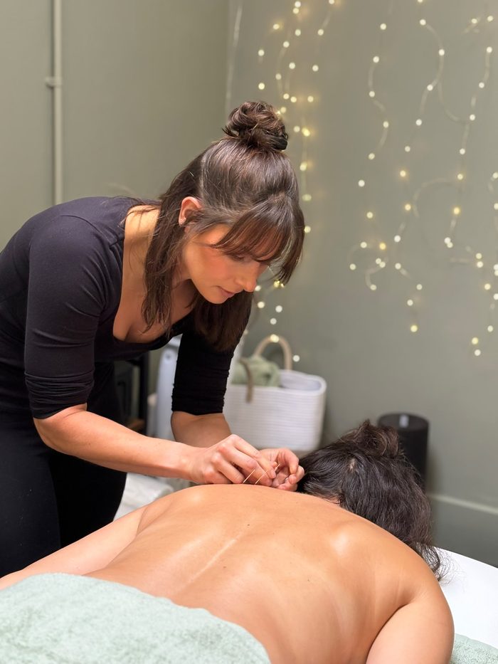 Clare applying dry needling to a client's upper back